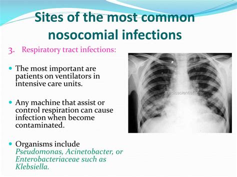 nosocomial pronunciation|common nosocomial infections.